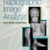 Test Bank for Radiographic Image Analysis